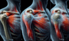 Acupuncture Techniques for Relief from Frozen Shoulder