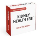 Kidney Blood Test: Your Local Newark-on-Trent Resource