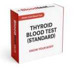 Thyroid Blood Test: Key Details for Residents of Newport