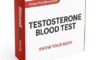 Hair Loss Blood Test: Expert Insights from Portsmouth